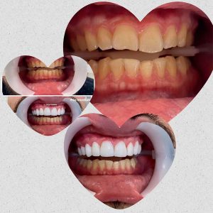 lentes-de-contato-01