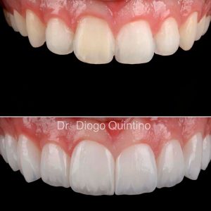 lentes-de-contato-02