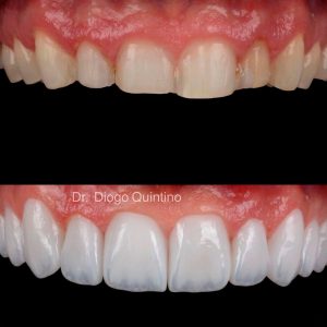 lentes-de-contato-04