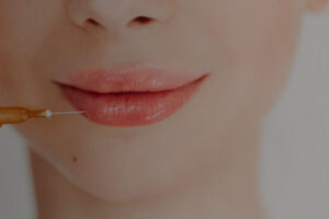 preenchimento-labial-destaques